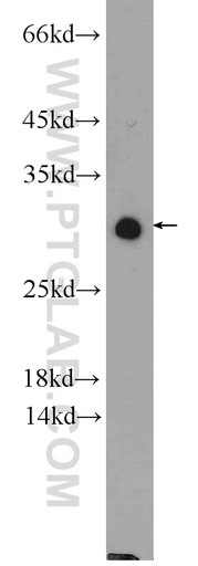 [25381-1-AP-150UL] NUP62CL Polyclonal antibody