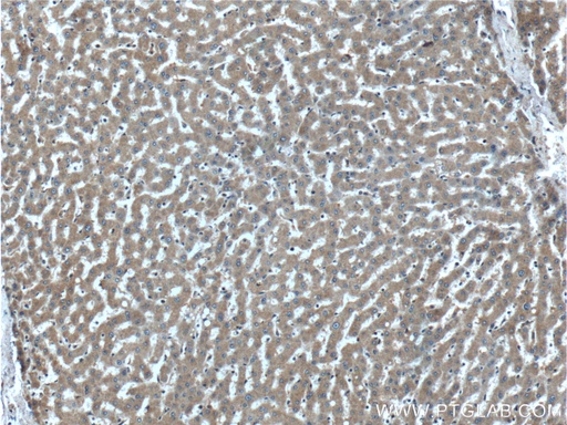 [25382-1-AP-20UL] PROC Polyclonal antibody