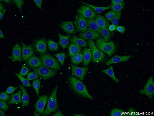 [25388-1-AP-20UL] FAM160B1 Polyclonal antibody