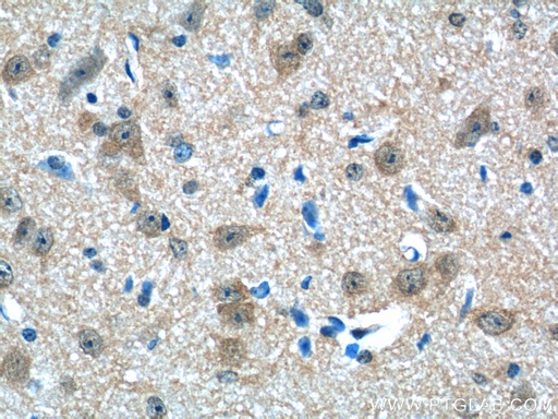 [25389-1-AP-20UL] CHERP Polyclonal antibody