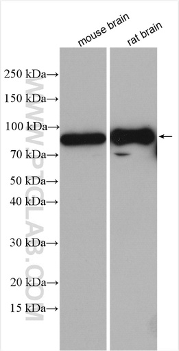 [25391-1-AP-150UL] RAP1GAP2 Polyclonal antibody