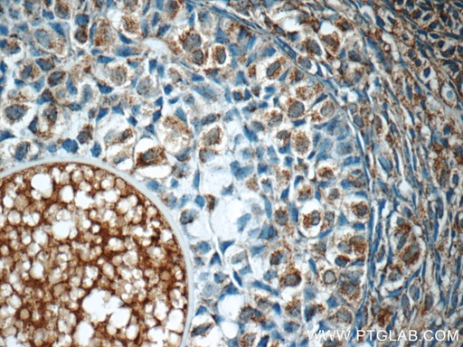 [25395-1-AP-20UL] FAM20C Polyclonal antibody