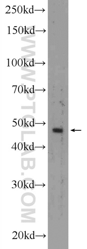 [25398-1-AP-20UL] KRT40 Polyclonal antibody