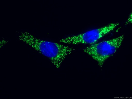 [25402-1-AP-150UL] SLC25A22 Polyclonal antibody