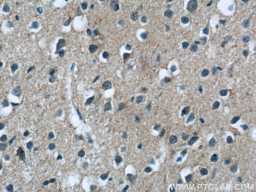 [25403-1-AP-20UL] MGC39372 Polyclonal antibody