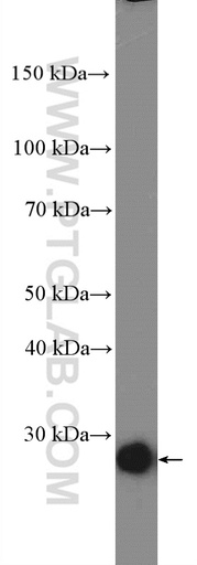 [25408-1-AP-150UL] C13orf27/TEX30 Polyclonal antibody