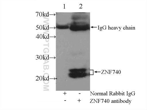 [25411-1-AP-150UL] ZNF740 Polyclonal antibody
