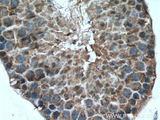 [25417-1-AP-20UL] SRPK2 Polyclonal antibody