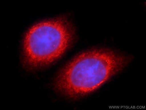 [25418-1-AP-20UL] TSC22D2 Polyclonal antibody