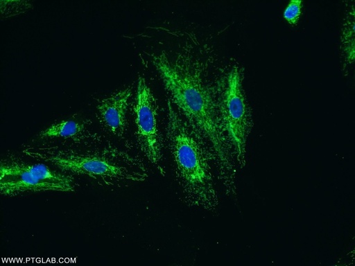 [25419-1-AP-20UL] KIAA0907 Polyclonal antibody