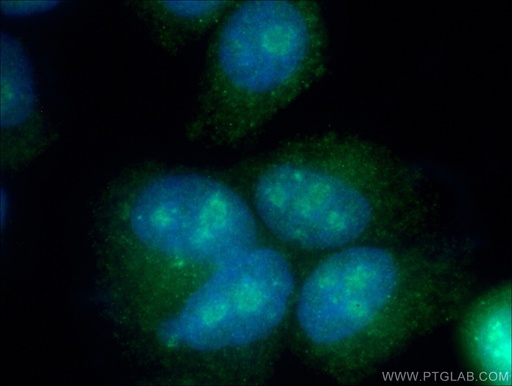 [25420-1-AP-20UL] DKC1 Polyclonal antibody