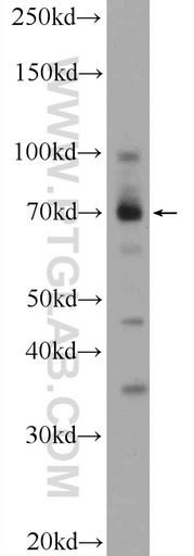 [25421-1-AP-20UL] ZBTB44 Polyclonal antibody