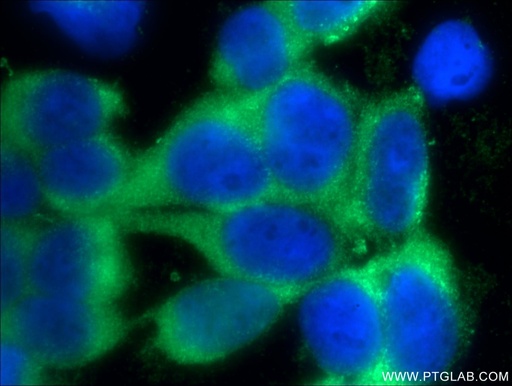 [25422-1-AP-150UL] TTC32 Polyclonal antibody