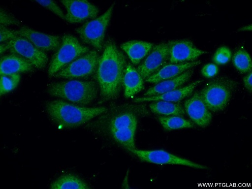 [25430-1-AP-150UL] OTUD6B Polyclonal antibody