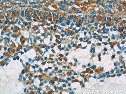 [25432-1-AP-150UL] BIVM Polyclonal antibody