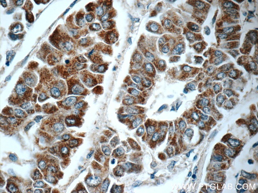 [25433-1-AP-20UL] C1orf56 Polyclonal antibody
