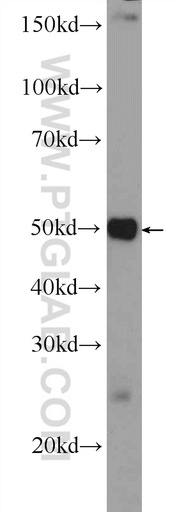 [25439-1-AP-150UL] SCML4 Polyclonal antibody