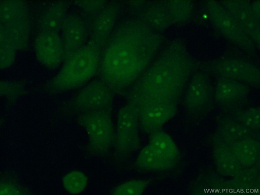 [25440-1-AP-20UL] RRP36 Polyclonal antibody