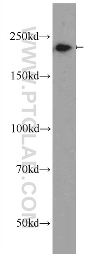 [25441-1-AP-20UL] Envoplakin Polyclonal antibody