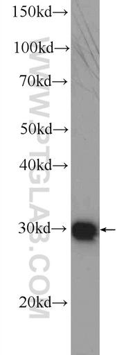 [25444-1-AP-20UL] DNAJC9 Polyclonal antibody