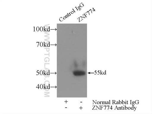 [25449-1-AP-150UL] ZNF774 Polyclonal antibody