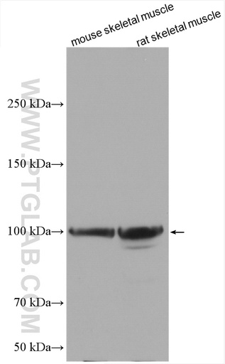 [25453-1-AP-150UL] Myopodin Polyclonal antibody