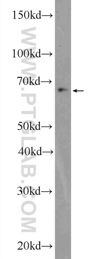 [25455-1-AP-20UL] ZBTB46 Polyclonal antibody