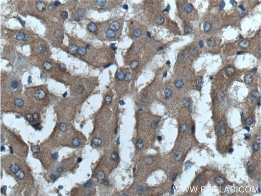 [25457-1-AP-20UL] VSTM2L Polyclonal antibody