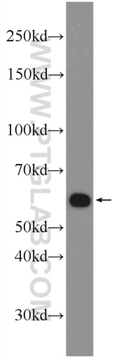 [25458-1-AP-20UL] ZNF211 Polyclonal antibody