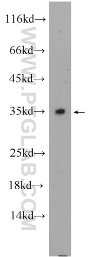 [25464-1-AP-20UL] C2orf51 Polyclonal antibody