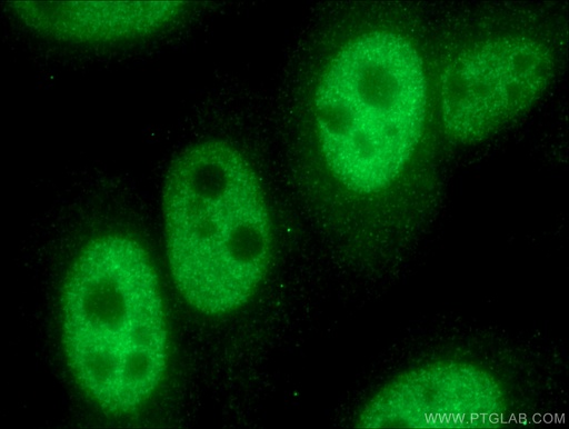 [25465-1-AP-150UL] TWIST1-specific Polyclonal antibody
