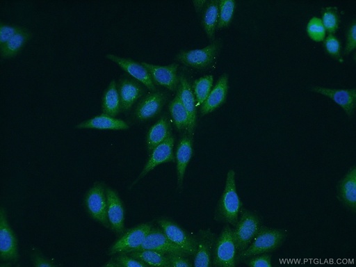 [25467-1-AP-20UL] SAAL1 Polyclonal antibody