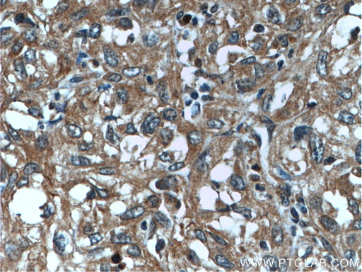 [25469-1-AP-20UL] PNPLA4 Polyclonal antibody