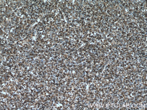[25471-1-AP-20UL] STK10 Polyclonal antibody