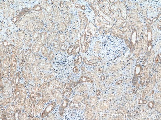 [25472-1-AP-20UL] MXRA5 Polyclonal antibody