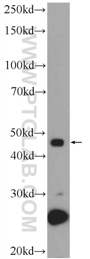 [25481-1-AP-20UL] ZNF506 Polyclonal antibody