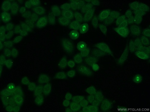 [25486-1-AP-20UL] CKAP2 Polyclonal antibody