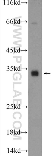 [25499-1-AP-150UL] C18orf45 Polyclonal antibody