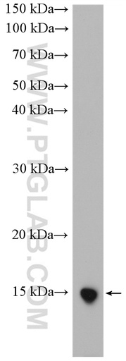 [25503-1-AP-20UL] UCMA Polyclonal antibody