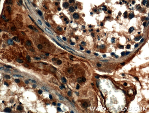 [25505-1-AP-150UL] TMEM102 Polyclonal antibody