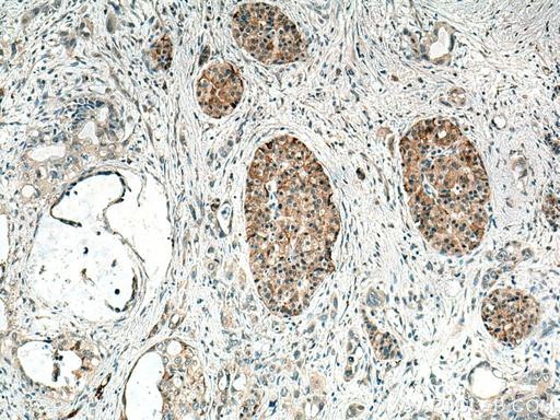 [25507-1-AP-150UL] TMEM24 Polyclonal antibody