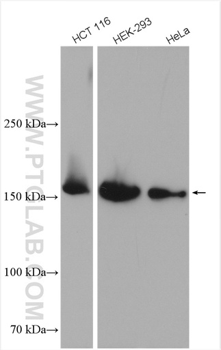 [25512-1-AP-20UL] PDZD8 Polyclonal antibody