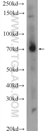 [25513-1-AP-150UL] MPZL3 Polyclonal antibody