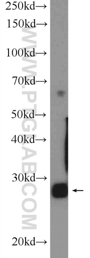 [25518-1-AP-150UL] PGAM2 Polyclonal antibody