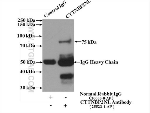 [25523-1-AP-150UL] CTTNBP2NL Polyclonal antibody