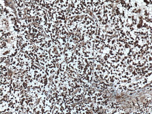 [25524-1-AP-20UL] Beta Amyloid Polyclonal antibody