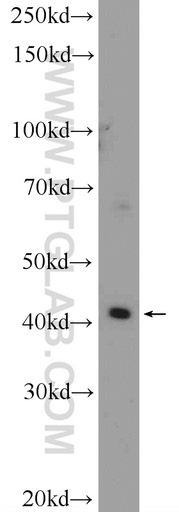 [25526-1-AP-150UL] SLC35F2 Polyclonal antibody