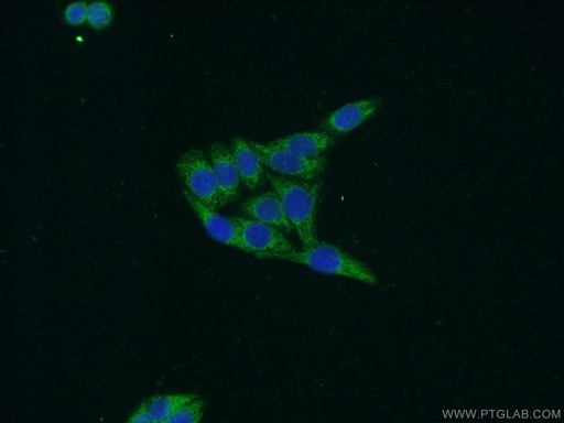 [25528-1-AP-150UL] WDR76 Polyclonal antibody