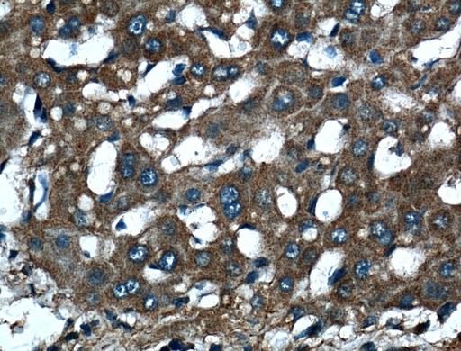 [25535-1-AP-150UL] DLL3 Polyclonal antibody