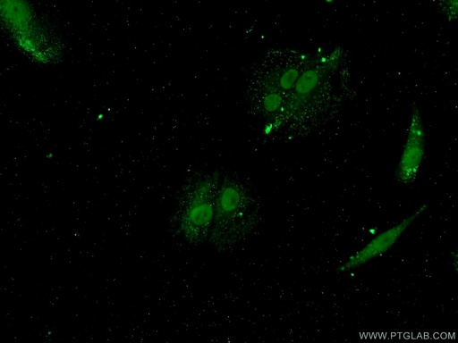 [25537-1-AP-150UL] YTHDF3-specific Polyclonal antibody